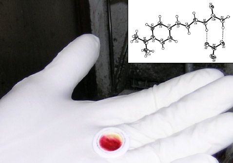 L'efficacia di uno spray con cellule della pelle nel trattamento delle ulcere trofiche