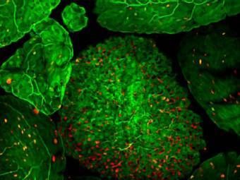 Gli scienziati stanno per creare vaccini orali per le malattie intestinali